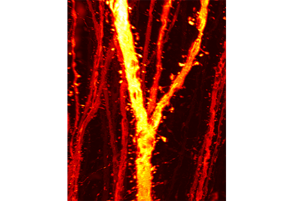 【医歯研】思春期における大脳皮質のシナプス形成が高次脳機能発達の鍵～統合失調症の病態メカニズムにも新説